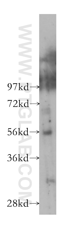 Western Blot (WB) analysis of SH-SY5Y cells using DOM3Z Polyclonal antibody (11015-2-AP)