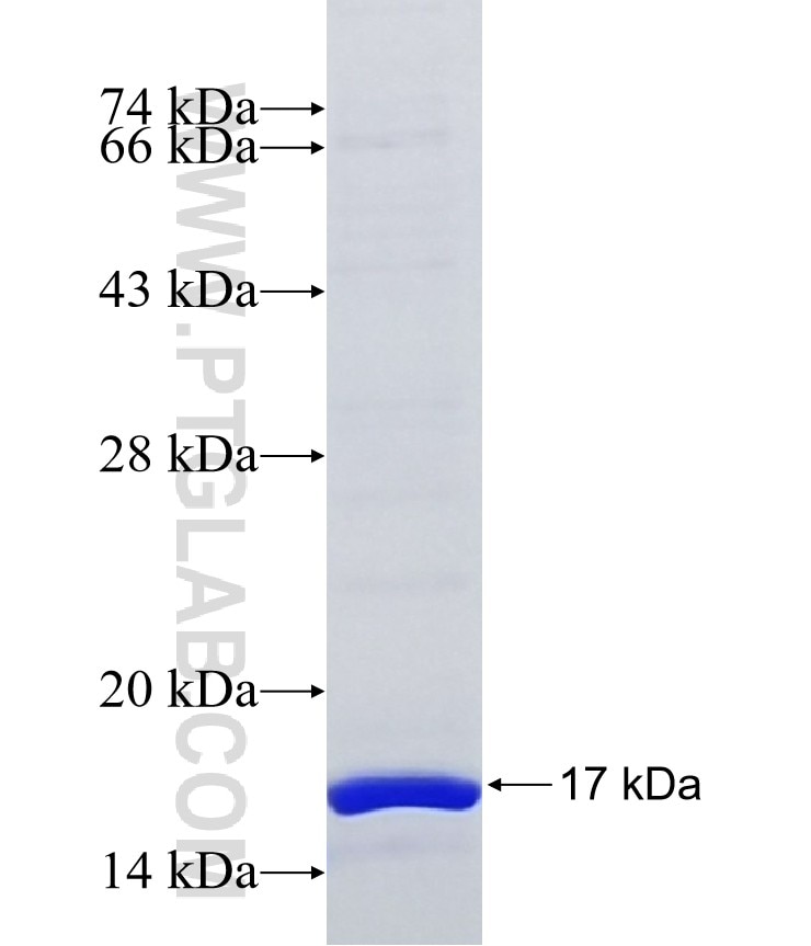 DONSON fusion protein Ag36503 SDS-PAGE DONSON fusion protein Ag36503 SDS-PAGE