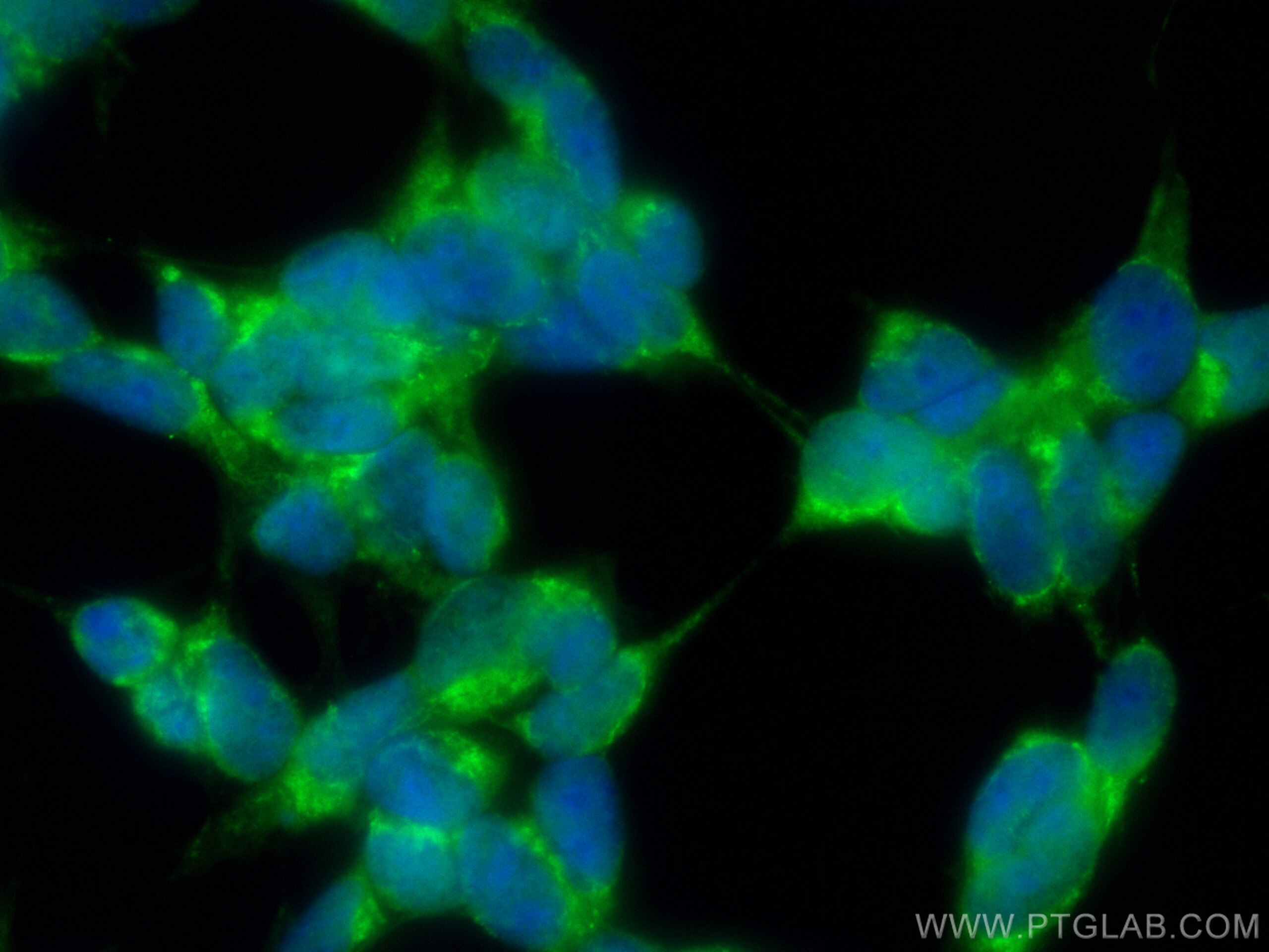 IF Staining of SH-SY5Y using CL488-10166