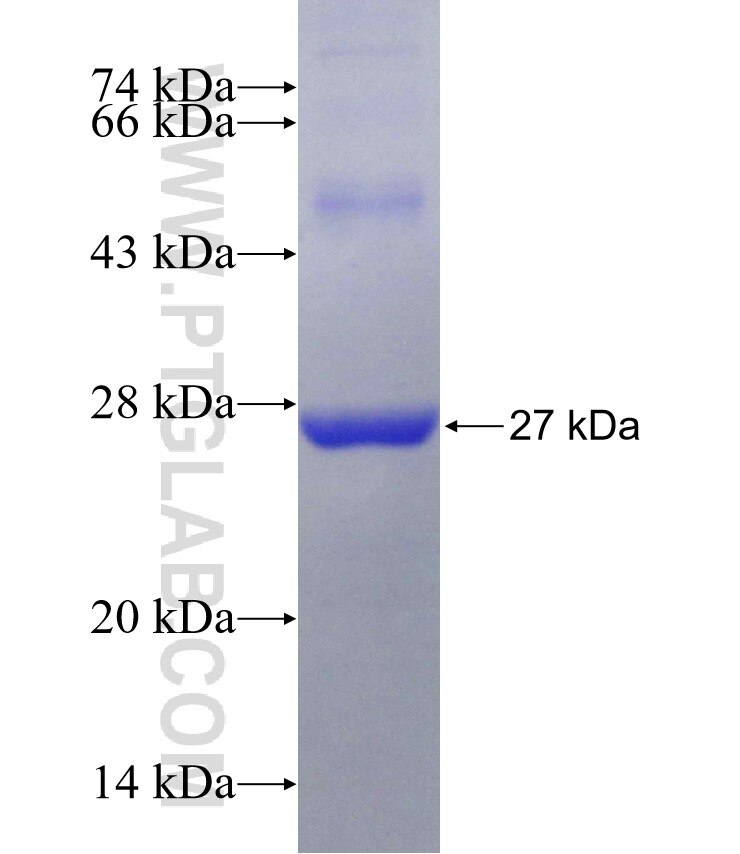DOT1L fusion protein Ag27160 SDS-PAGE