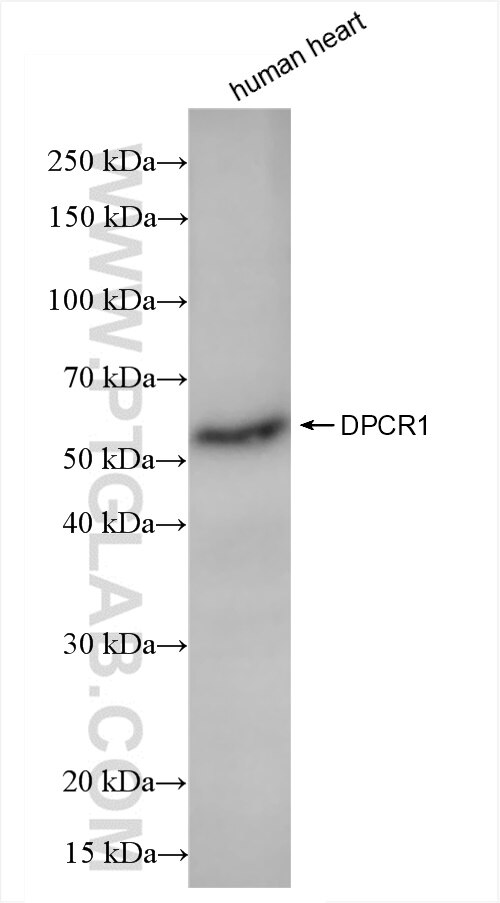 Western Blot (WB) analysis of human heart tissue using DPCR1 Recombinant antibody (84567-2-RR)