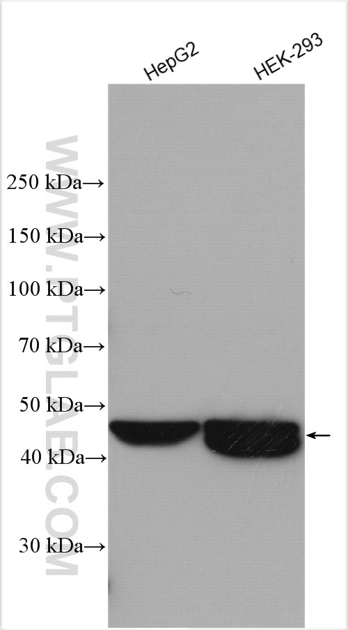 Western Blot (WB) analysis of various lysates using DPEP1 Polyclonal antibody (12222-1-AP)