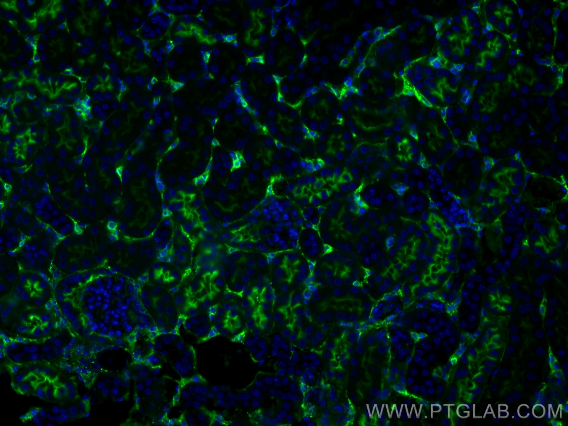 Immunofluorescence (IF) / fluorescent staining of mouse kidney tissue using DPEP1 Monoclonal antibody (68081-1-Ig)