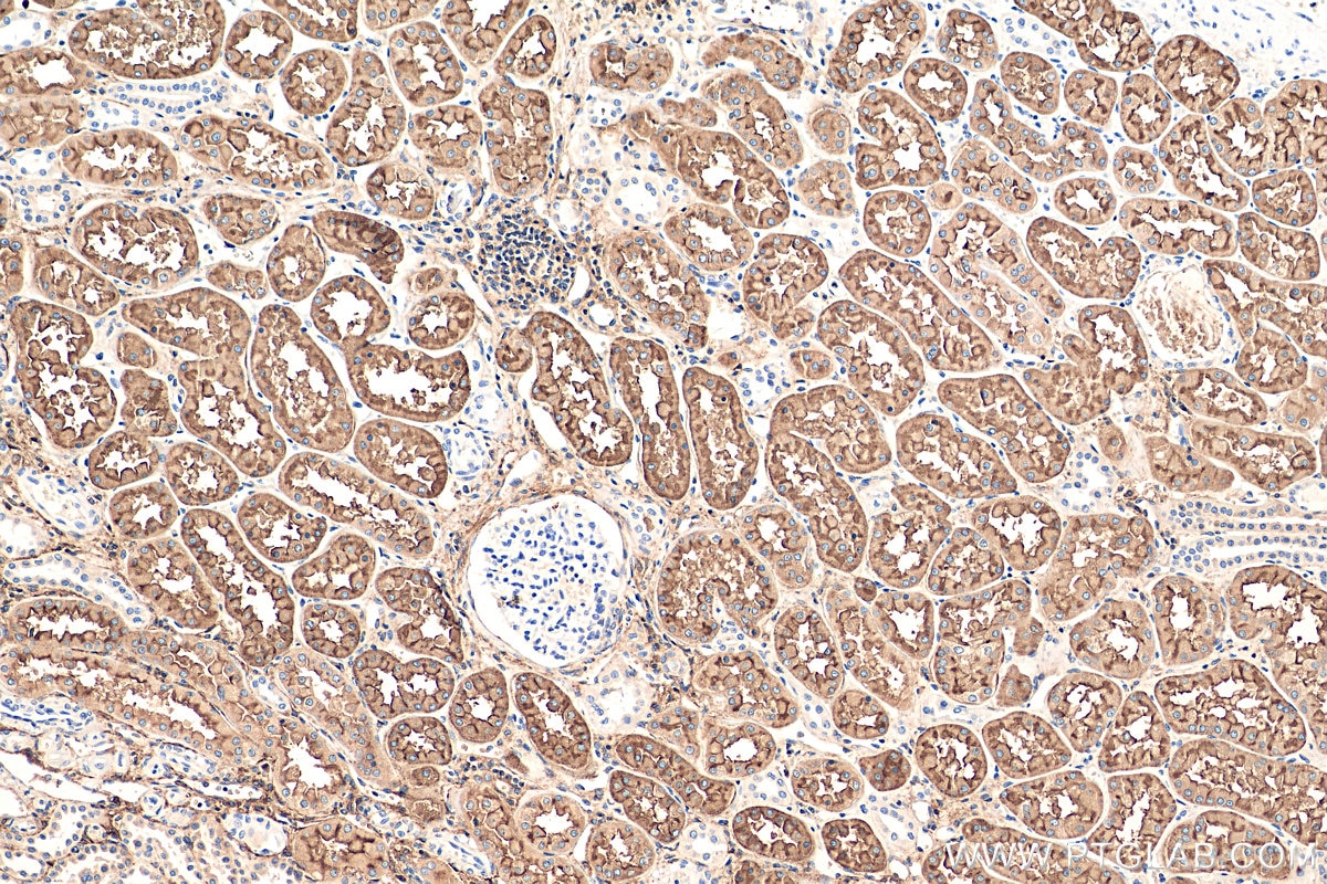 Immunohistochemistry (IHC) staining of human kidney tissue using DPEP1 Monoclonal antibody (68081-1-Ig)