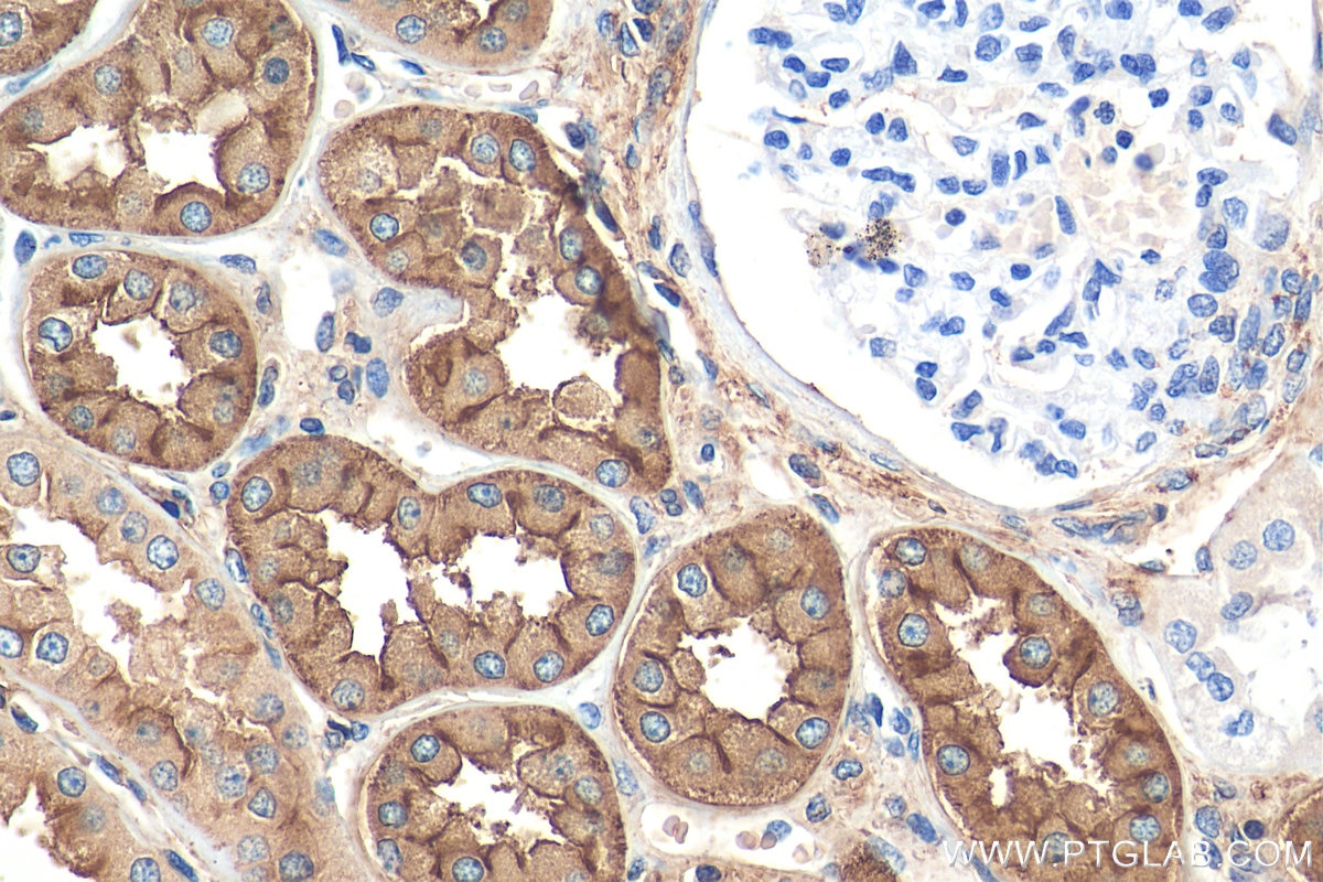 Immunohistochemistry (IHC) staining of human kidney tissue using DPEP1 Monoclonal antibody (68081-1-Ig)