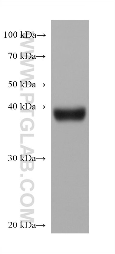 WB analysis of pig pancreas using 68081-1-Ig