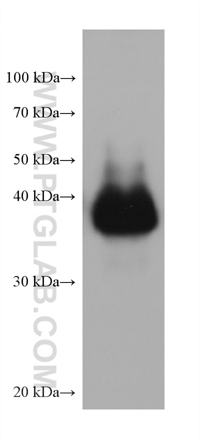 WB analysis of rabbit kidney using 68081-1-Ig