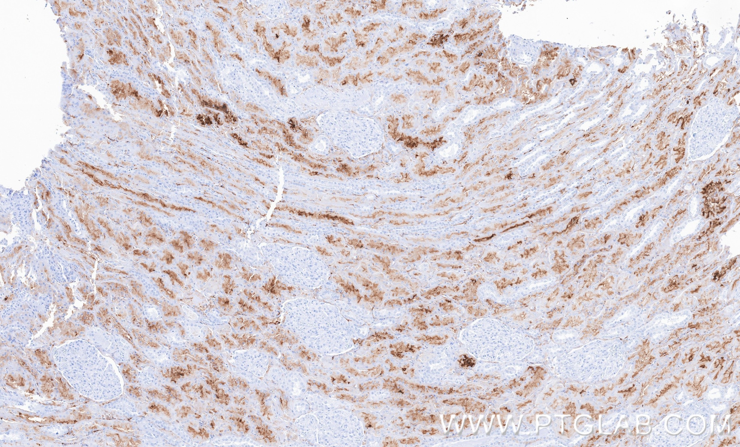 IHC staining of human kidney using 87384-1-RR Immunohistochemistry (IHC) staining of human kidney tissue using DPEP1 Recombinant monoclonal antibody (87384-1-RR)