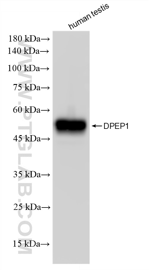 Western Blot (WB) analysis of human testis tissue using DPEP1 Recombinant monoclonal antibody (87384-1-RR)