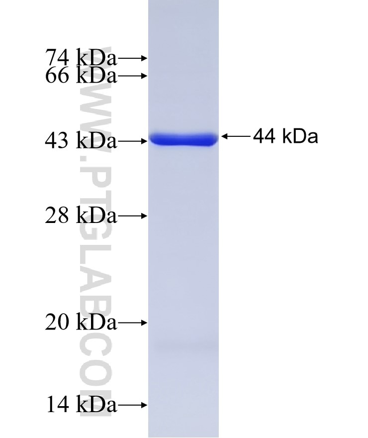 DPEP1 fusion protein Ag14591 SDS-PAGE