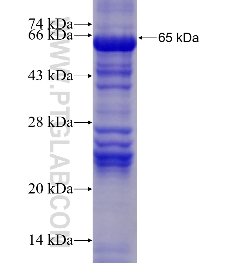 DPEP1 fusion protein Ag2907 SDS-PAGE