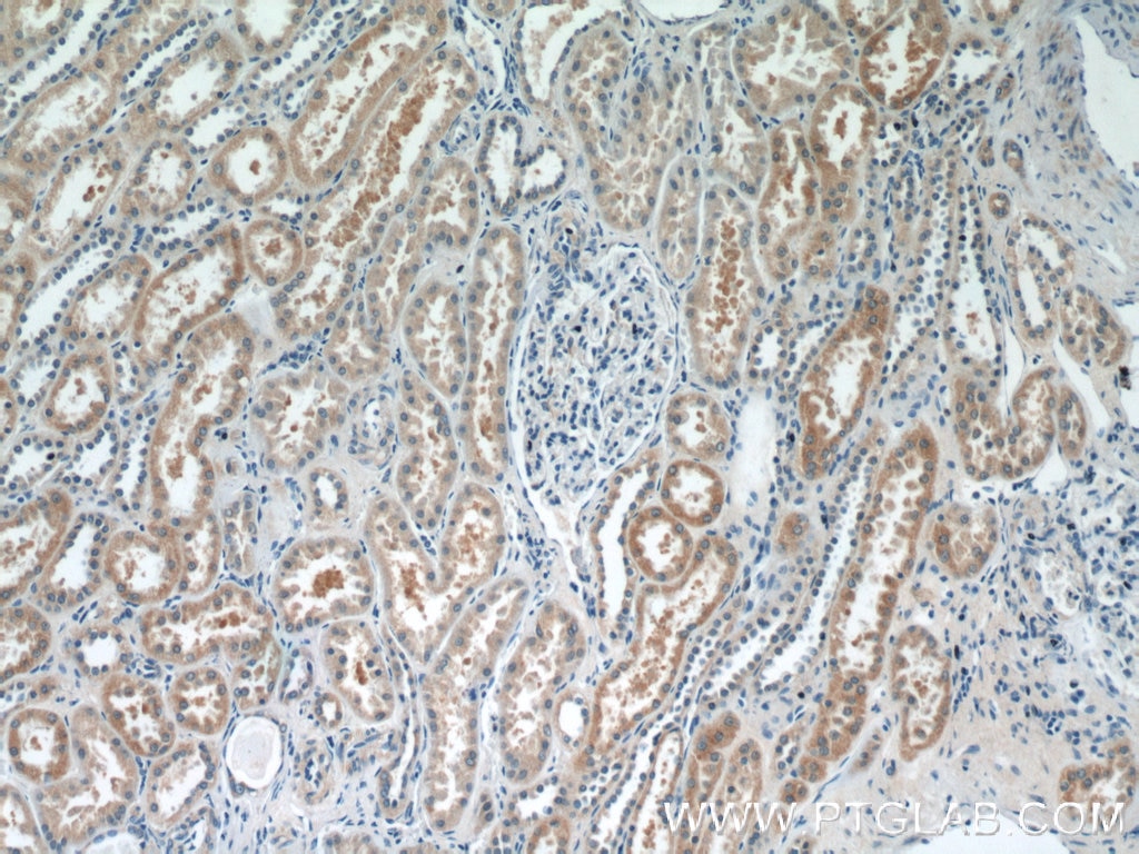 Immunohistochemistry (IHC) staining of human kidney tissue using DPEP2 Polyclonal antibody (16466-1-AP)