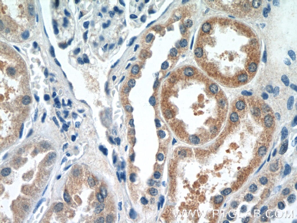 Immunohistochemistry (IHC) staining of human kidney tissue using DPEP2 Polyclonal antibody (16466-1-AP)