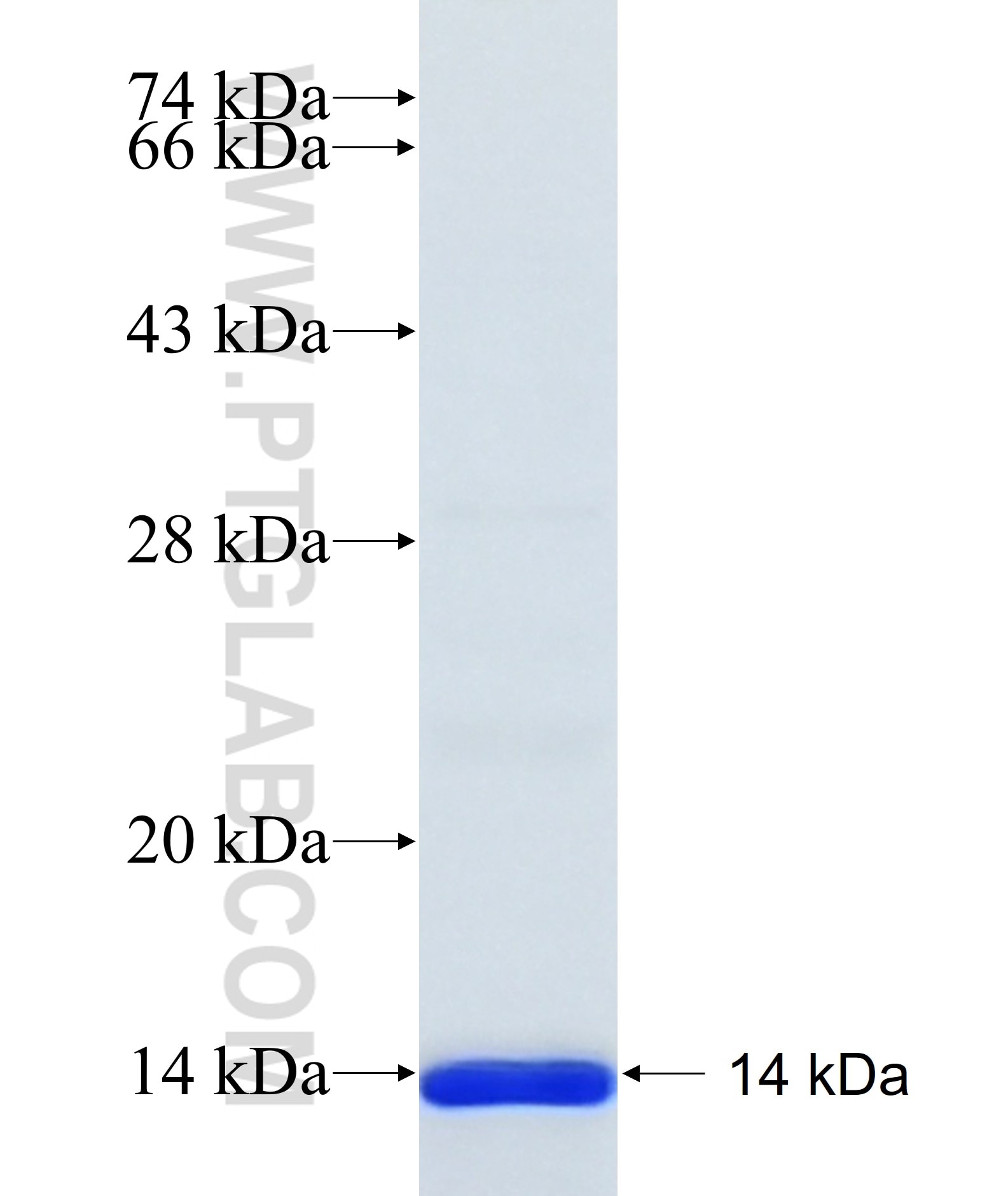 DPEP3 fusion protein Ag35863 SDS-PAGE