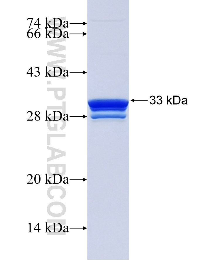 DPEP3 fusion protein Ag36039 SDS-PAGE