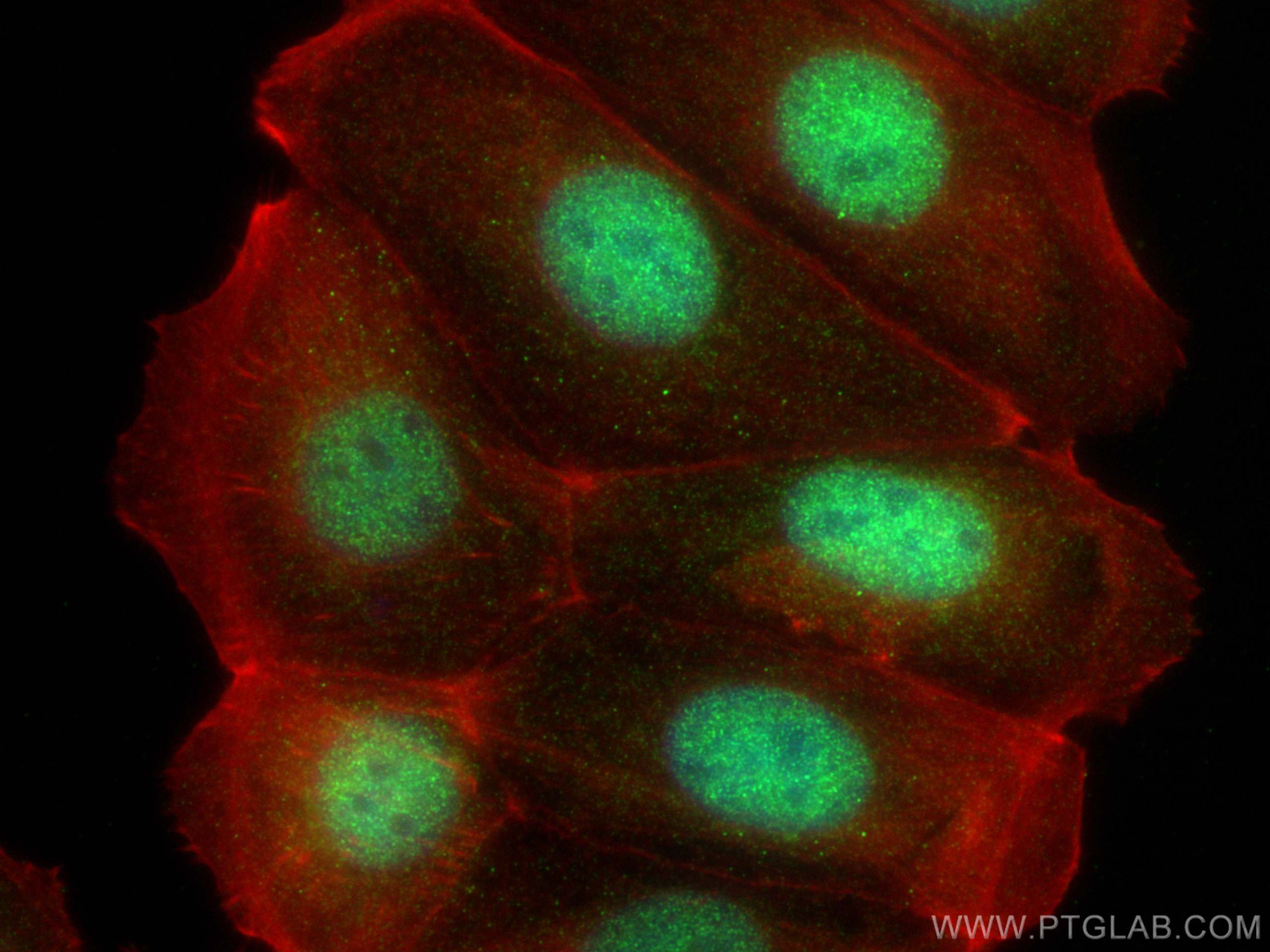 Immunofluorescence (IF) / fluorescent staining of MCF-7 cells using DPF1 Polyclonal antibody (21769-1-AP)