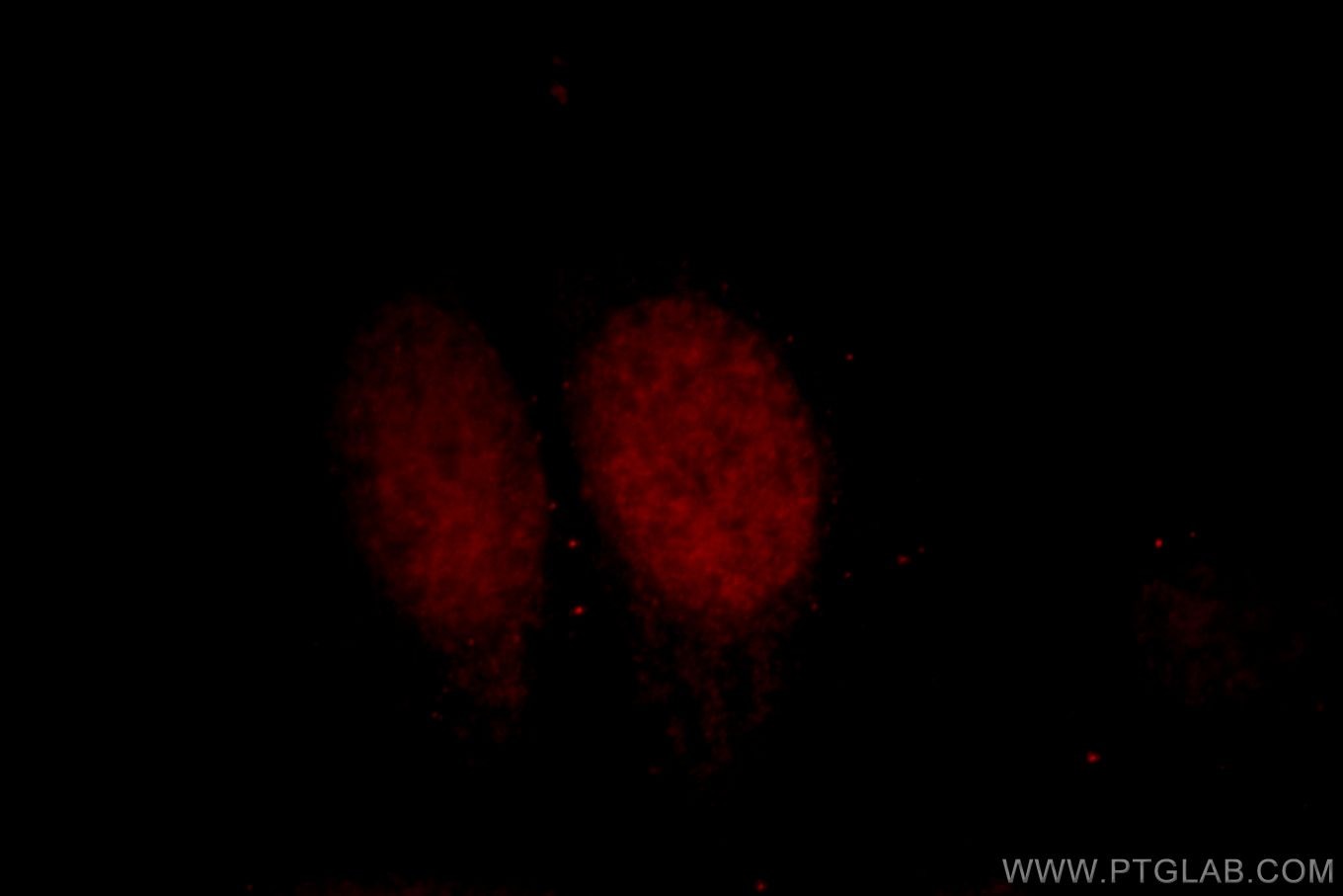 Immunofluorescence (IF) / fluorescent staining of HepG2 cells using DPF2 Polyclonal antibody (12111-1-AP)