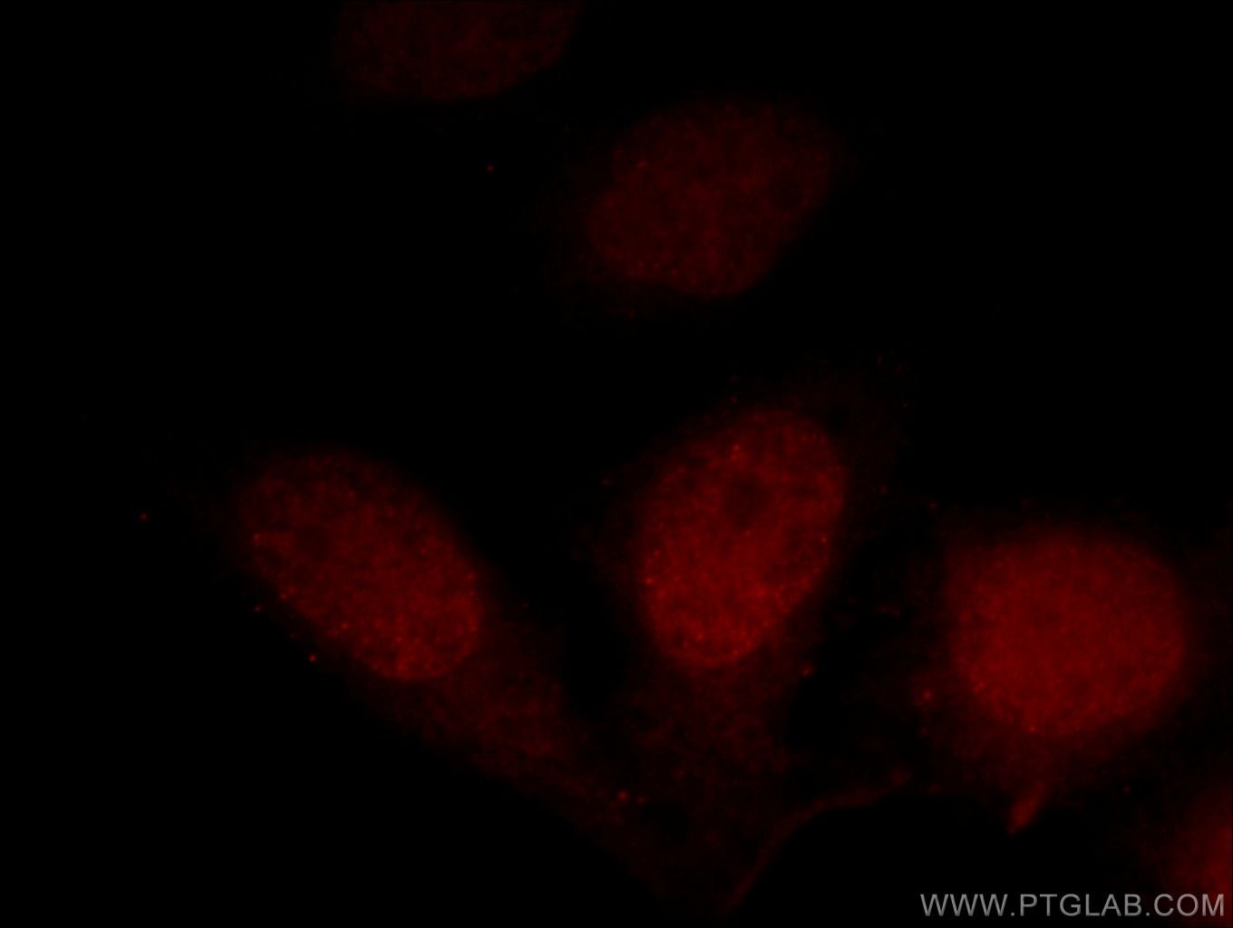 Immunofluorescence (IF) / fluorescent staining of HeLa cells using DPF2 Polyclonal antibody (12111-1-AP)