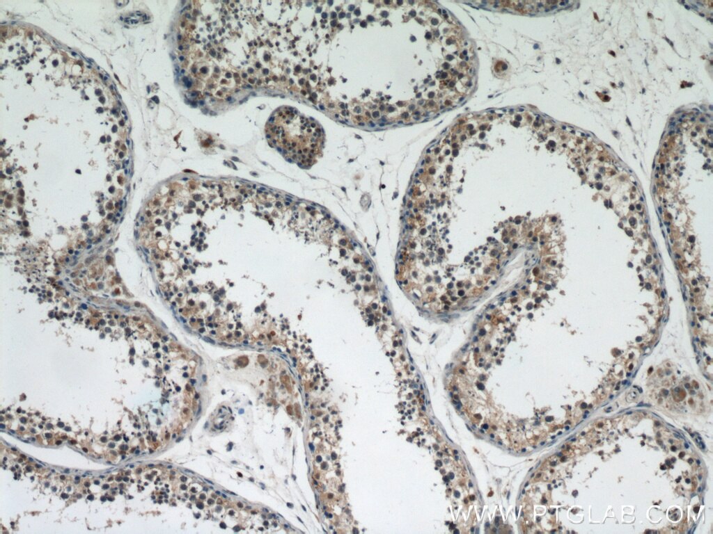Immunohistochemistry (IHC) staining of human testis tissue using DPF2 Polyclonal antibody (12111-1-AP)