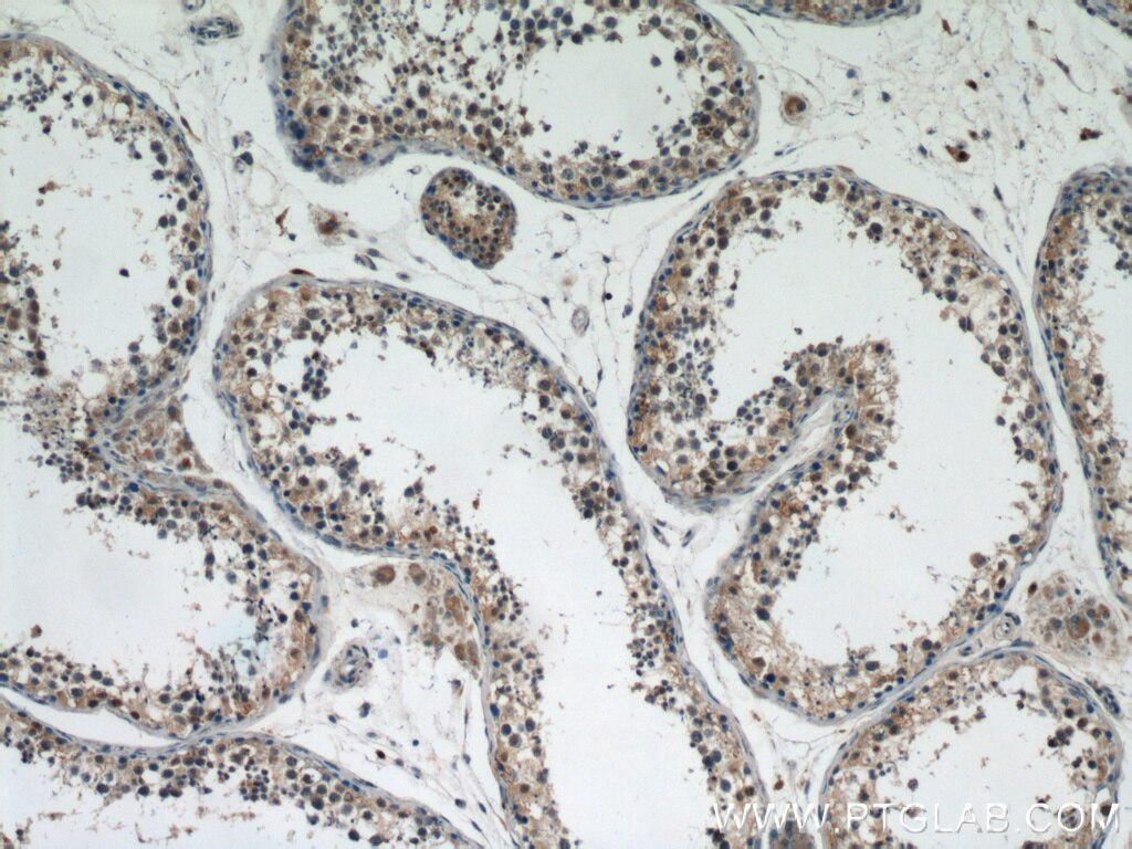 IHC staining of human testis using 12111-1-AP