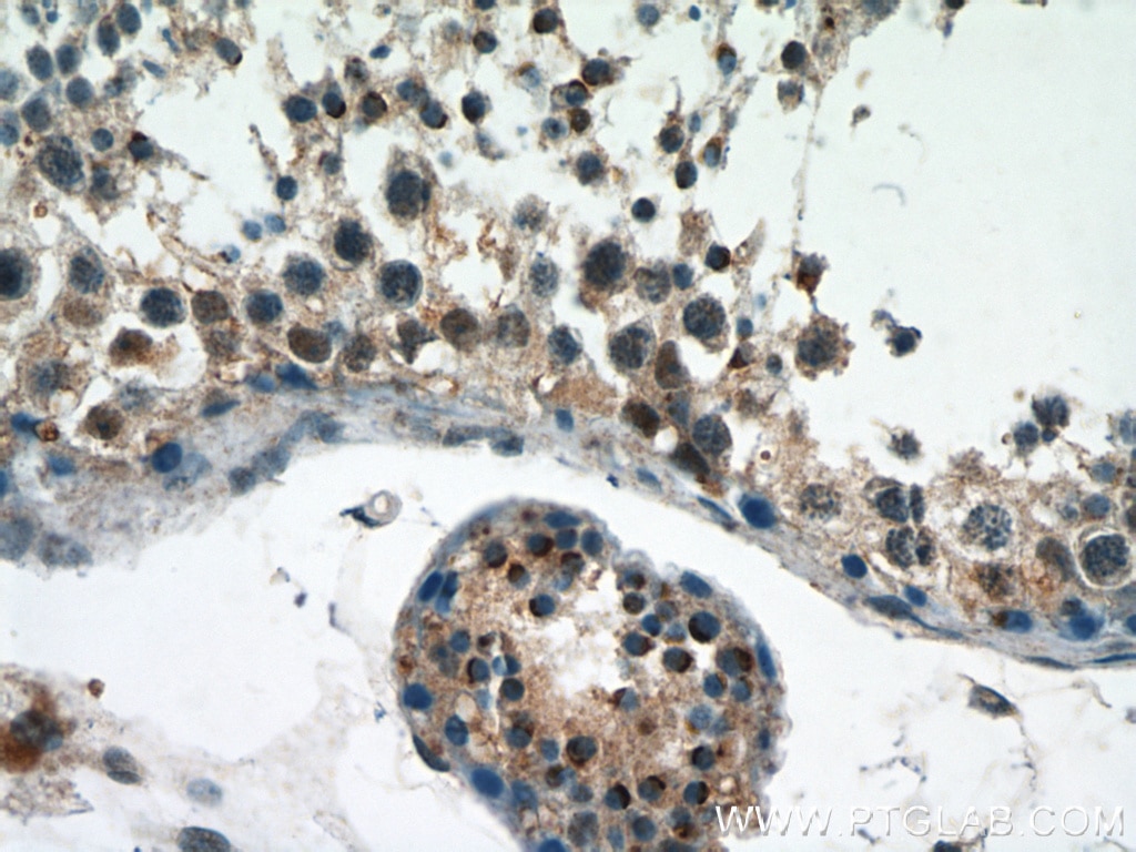 Immunohistochemistry (IHC) staining of human testis tissue using DPF2 Polyclonal antibody (12111-1-AP)