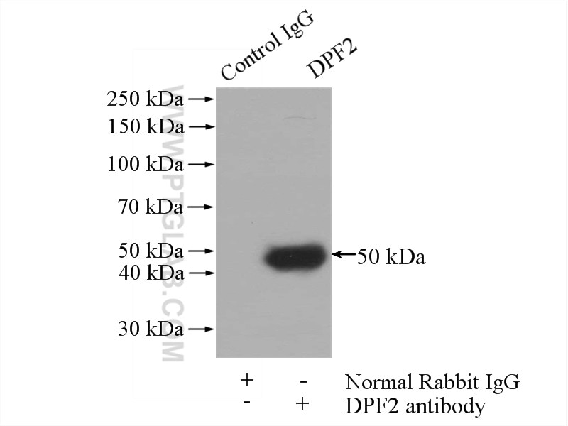 Immunoprecipitation (IP) experiment of Jurkat cells using DPF2 Polyclonal antibody (12111-1-AP)