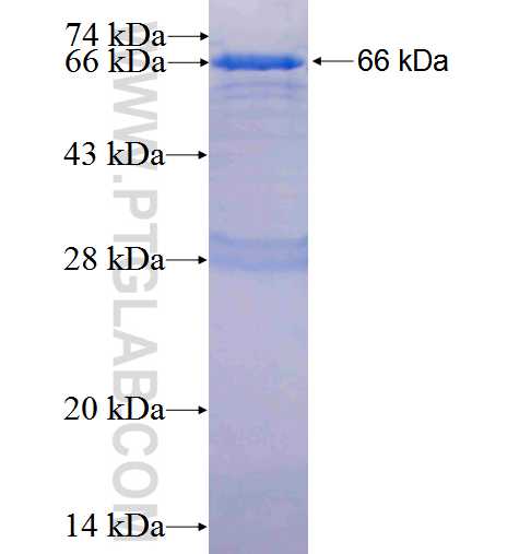 DPF2 fusion protein Ag2756 SDS-PAGE