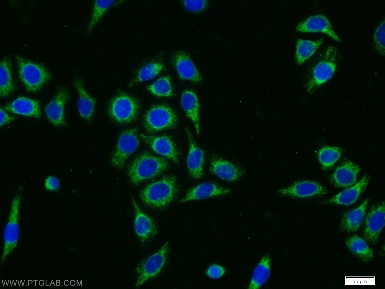 Immunofluorescence (IF) / fluorescent staining of PC-3 cells using DPH2 Polyclonal antibody (12367-1-AP)