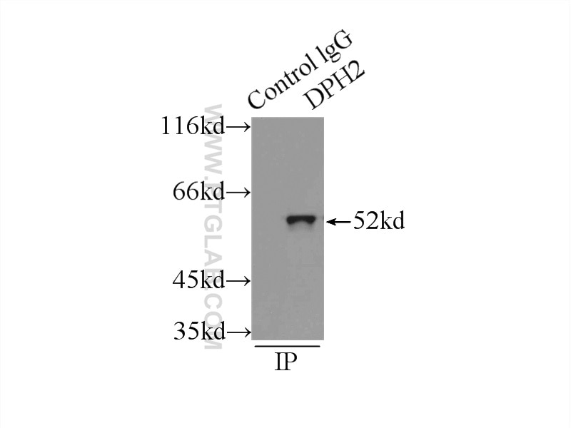 Immunoprecipitation (IP) experiment of mouse skeletal muscle tissue using DPH2 Polyclonal antibody (12367-1-AP)