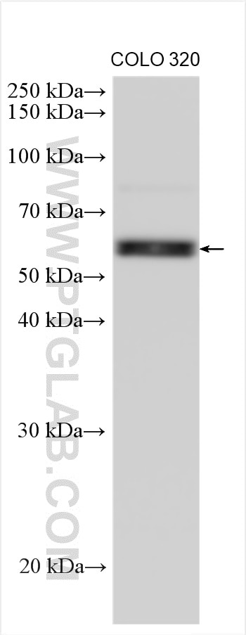 Western Blot (WB) analysis of various lysates using DPH2 Polyclonal antibody (12367-1-AP)