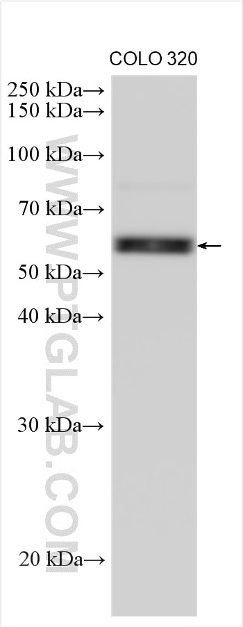 WB analysis using 12367-1-AP