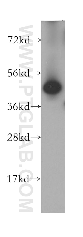 Western Blot (WB) analysis of human brain tissue using DPH2 Polyclonal antibody (12367-1-AP)