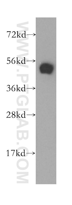 Western Blot (WB) analysis of PC-3 cells using DPH2 Polyclonal antibody (12367-1-AP)