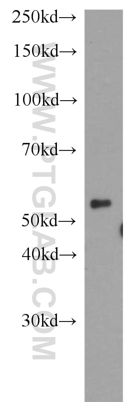 Western Blot (WB) analysis of HeLa cells using DPH2 Polyclonal antibody (14866-1-AP)