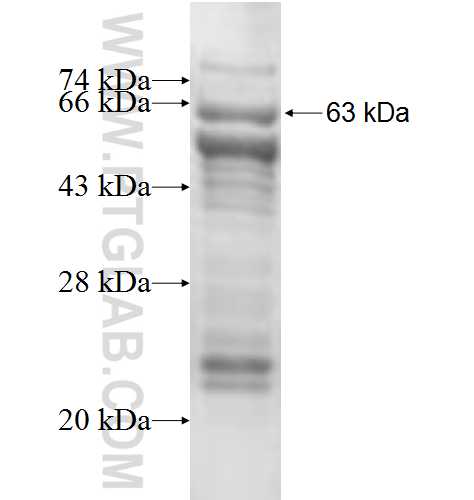 DPH2 fusion protein Ag6678 SDS-PAGE