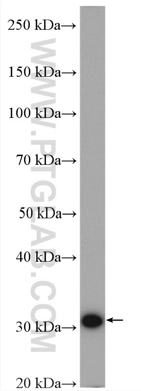 WB analysis of HeLa using 12403-2-AP