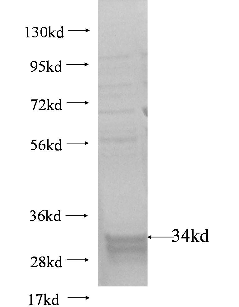 DPM2 fusion protein Ag3003 SDS-PAGE