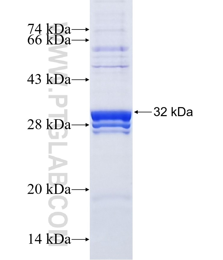 DPM2 fusion protein Ag3003 SDS-PAGE