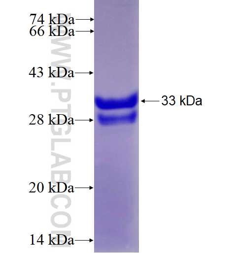 DPM3 fusion protein Ag3899 SDS-PAGE