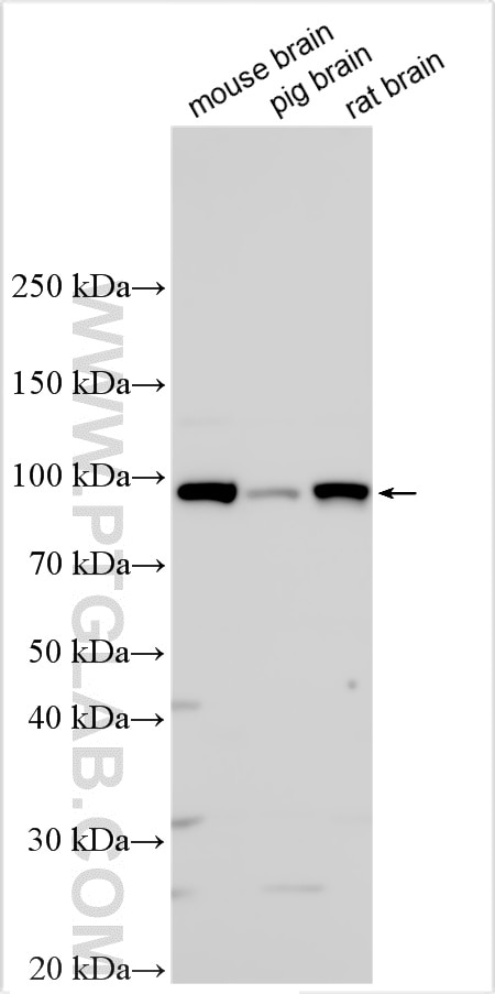 Western Blot (WB) analysis of various lysates using DPP10 Polyclonal antibody (12553-1-AP)
