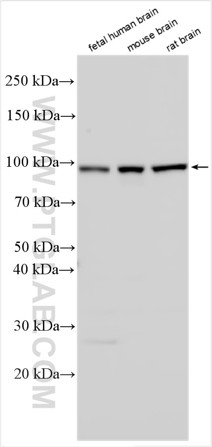 Western Blot (WB) analysis of various lysates using DPP10 Polyclonal antibody (12553-1-AP)