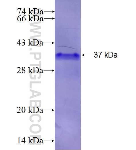 DPP10 fusion protein Ag25644 SDS-PAGE
