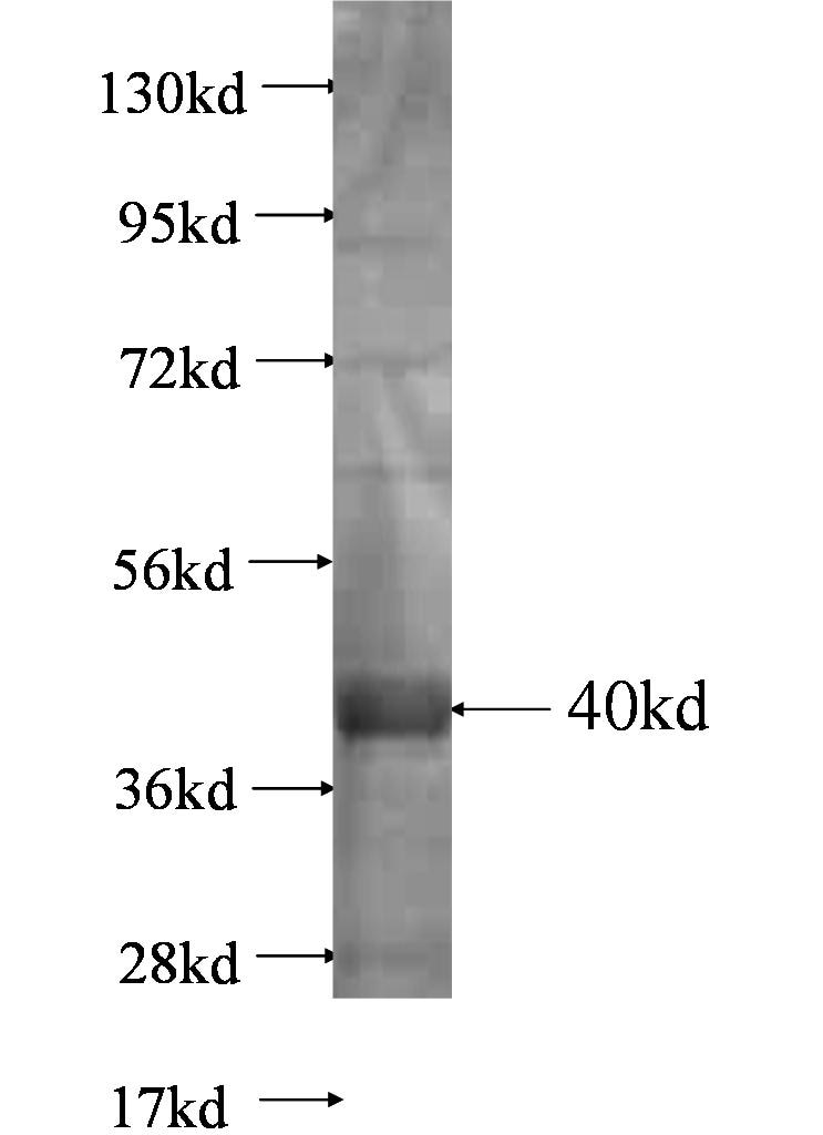 DPP10 fusion protein Ag0657 SDS-PAGE