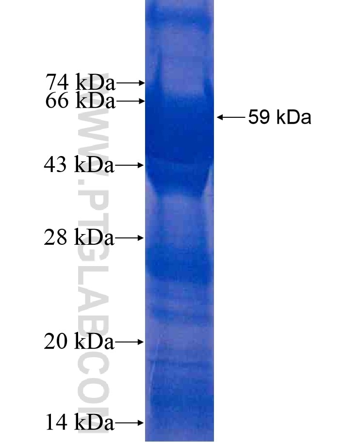 DPP3 fusion protein Ag1022 SDS-PAGE