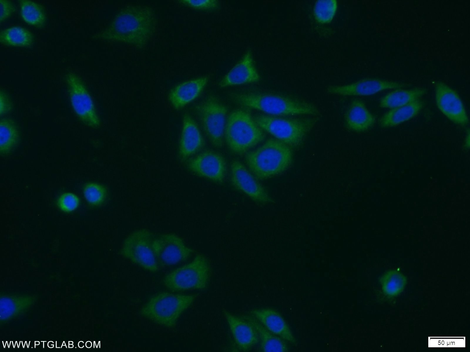 Immunofluorescence (IF) / fluorescent staining of PC-3 cells using DPP4/CD26 Polyclonal antibody (10940-1-AP)