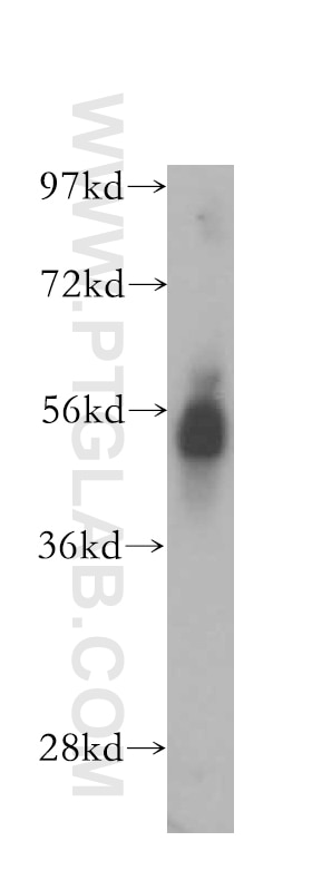 Western Blot (WB) analysis of PC-3 cells using DPP4/CD26 Polyclonal antibody (10940-1-AP)