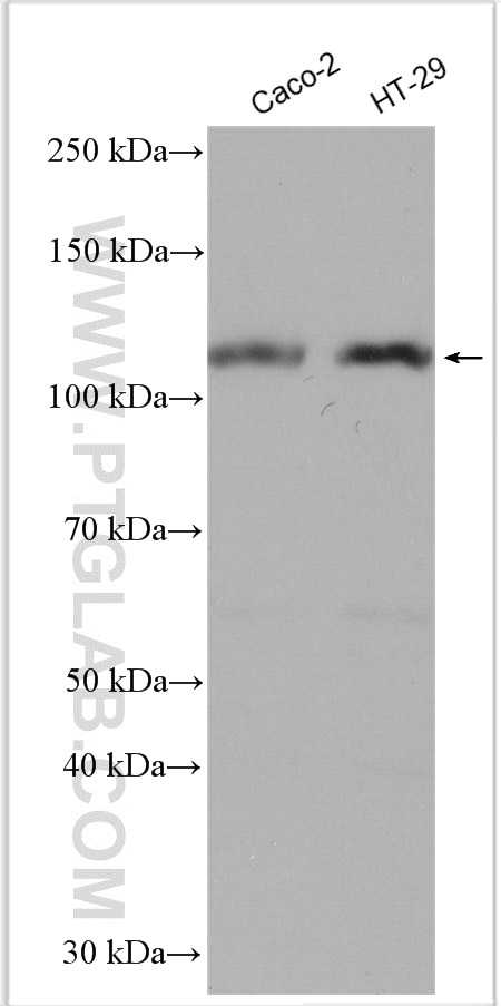 Western Blot (WB) analysis of various lysates using DPP4/CD26 Polyclonal antibody (29403-1-AP)