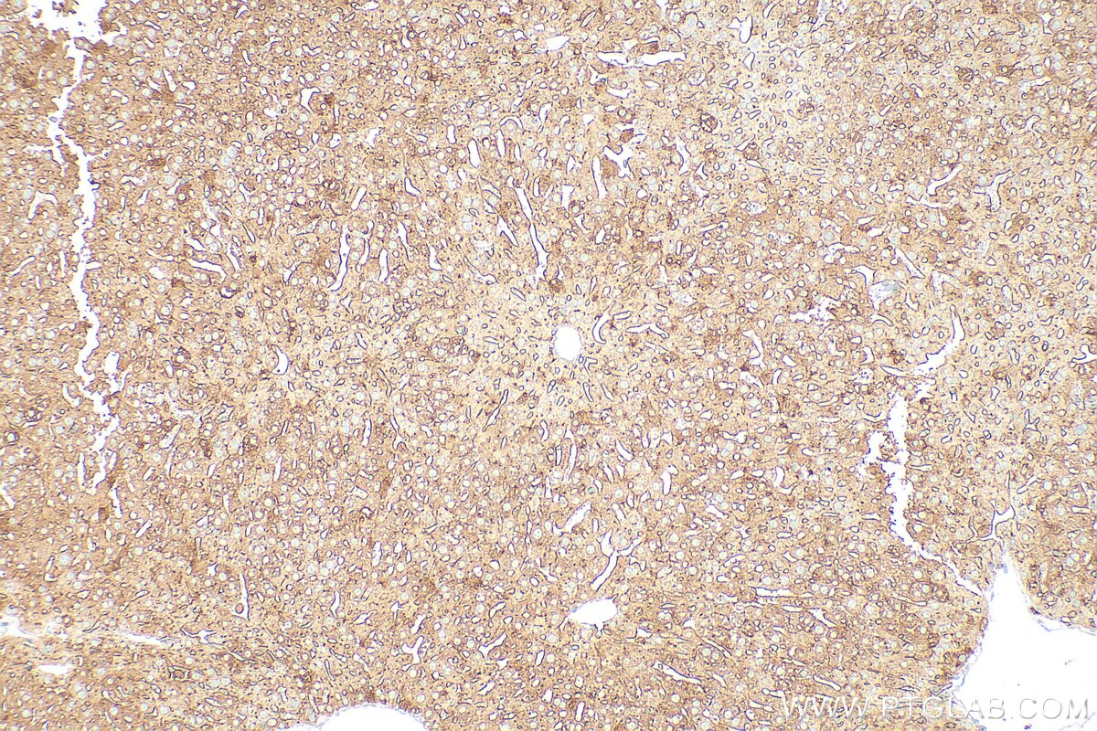 Immunohistochemistry (IHC) staining of mouse liver tissue using DPP4/CD26 Polyclonal antibody (32397-1-AP)