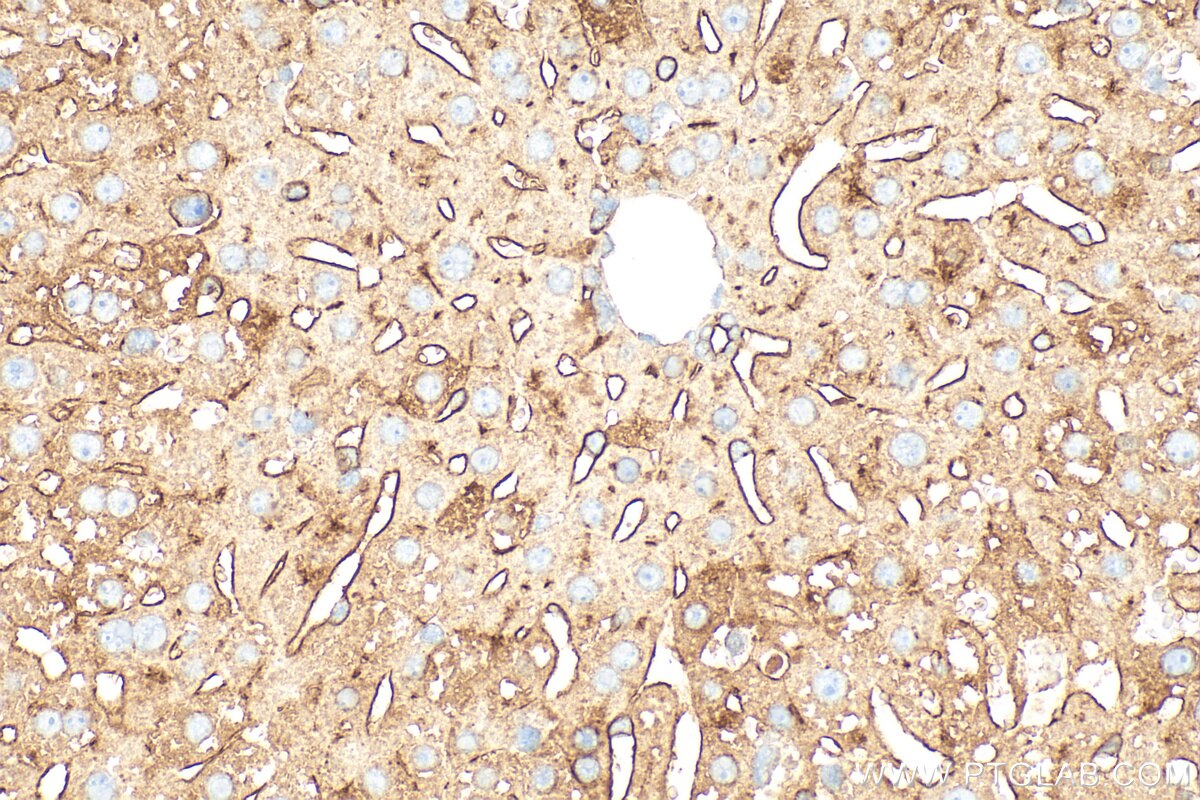 Immunohistochemistry (IHC) staining of mouse liver tissue using DPP4/CD26 Polyclonal antibody (32397-1-AP)