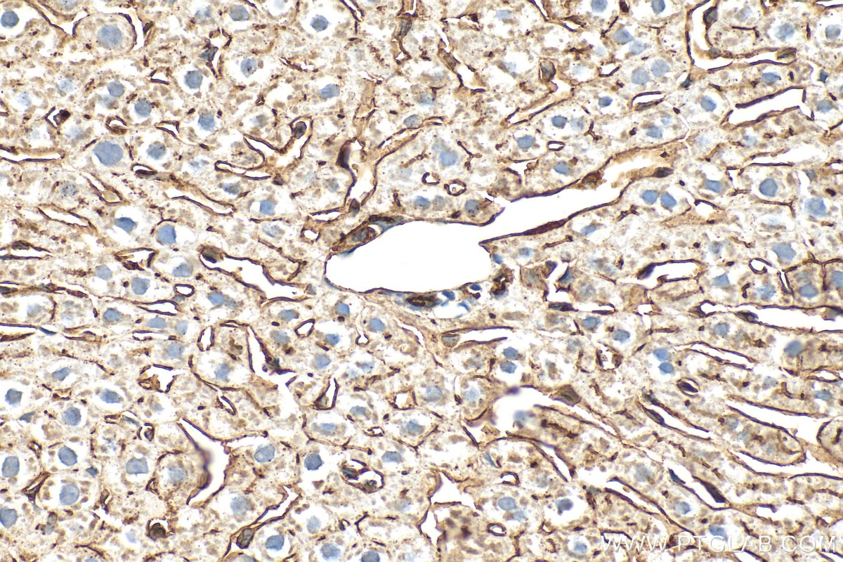 Immunohistochemistry (IHC) staining of rat liver tissue using DPP4/CD26 Polyclonal antibody (32397-1-AP)